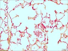 Gram Stain Kit for Tissue