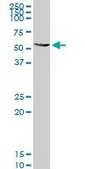 Anti-ALDH4A1 antibody produced in rabbit purified immunoglobulin, buffered aqueous solution