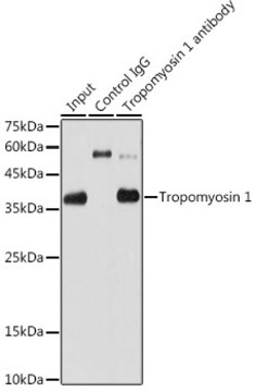 Anti-Tropomyosin 1 Antibody, clone 5Q2H6, Rabbit Monoclonal