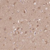 Anti-PARP3 antibody produced in rabbit Prestige Antibodies&#174; Powered by Atlas Antibodies, affinity isolated antibody, buffered aqueous glycerol solution