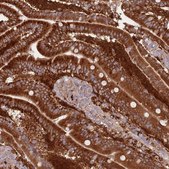 Anti-LPIN2 antibody produced in rabbit Prestige Antibodies&#174; Powered by Atlas Antibodies, affinity isolated antibody, buffered aqueous glycerol solution
