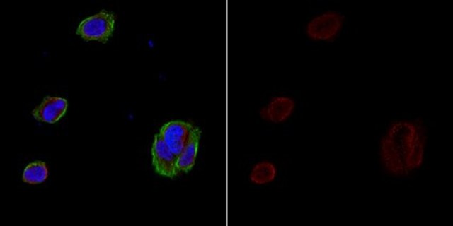 Anti-APP A4 Antibody, a.a. 66-81 of APP {NT}, clone 22C11, Alexa Fluor&#8482; 555 clone 22C11, from mouse, ALEXA FLUOR&#8482; 555