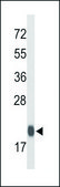 ANTI-GPX1 (C-TERM) antibody produced in rabbit IgG fraction of antiserum, buffered aqueous solution