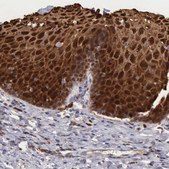 Anti-CSTA antibody produced in rabbit Prestige Antibodies&#174; Powered by Atlas Antibodies, affinity isolated antibody, buffered aqueous glycerol solution