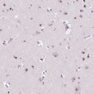 Anti-NOLC1 antibody produced in rabbit Prestige Antibodies&#174; Powered by Atlas Antibodies, affinity isolated antibody, buffered aqueous glycerol solution