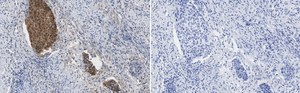 Anti-p16-INK4a Antibody, clone 5F22 Antibody, ZooMAb&#174; Rabbit Monoclonal recombinant, expressed in HEK 293 cells