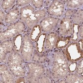 Anti-STAT3 antibody produced in rabbit Prestige Antibodies&#174; Powered by Atlas Antibodies, affinity isolated antibody, buffered aqueous glycerol solution