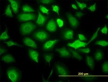 Monoclonal Anti-KRT20 antibody produced in mouse clone 2G3-1C8, purified immunoglobulin, buffered aqueous solution