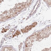 Anti-CHD1 antibody produced in rabbit Prestige Antibodies&#174; Powered by Atlas Antibodies, affinity isolated antibody, buffered aqueous glycerol solution