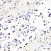 Anti-Phospho-c-Myc-T58 antibody produced in rabbit