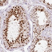 Anti-KPNA2 antibody produced in rabbit Prestige Antibodies&#174; Powered by Atlas Antibodies, affinity isolated antibody, buffered aqueous glycerol solution