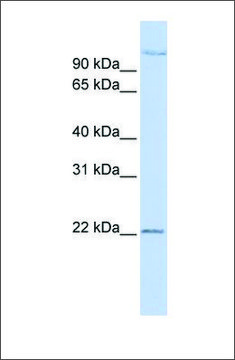 Anti-PDS5B antibody produced in rabbit affinity isolated antibody