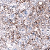 Anti-CD99 antibody produced in mouse Prestige Antibodies&#174; Powered by Atlas Antibodies, clone CL12929, purified by using Protein A, buffered aqueous glycerol solution