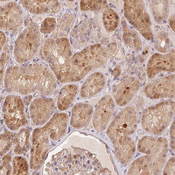 Anti-NUDT16 antibody produced in rabbit Prestige Antibodies&#174; Powered by Atlas Antibodies, affinity isolated antibody, buffered aqueous glycerol solution