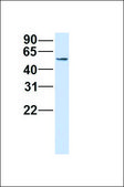 Anti-USP22 (ab2) antibody produced in rabbit affinity isolated antibody