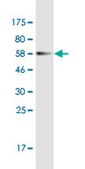Monoclonal Anti-PPP4C antibody produced n mouse clone 1E8, purified immunoglobulin, buffered aqueous solution