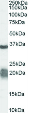 Anti-Arginase, Type 1/ARG1 (AB1) antibody produced in goat affinity isolated antibody, buffered aqueous solution