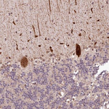 Anti-ALKBH8 antibody produced in rabbit Prestige Antibodies&#174; Powered by Atlas Antibodies, affinity isolated antibody, buffered aqueous glycerol solution