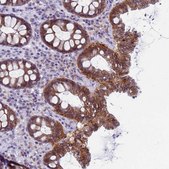 Anti-CDK2AP2 antibody produced in rabbit Prestige Antibodies&#174; Powered by Atlas Antibodies, affinity isolated antibody, buffered aqueous glycerol solution
