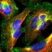 Anti-PPFIBP1 antibody produced in rabbit Prestige Antibodies&#174; Powered by Atlas Antibodies, affinity isolated antibody, buffered aqueous glycerol solution