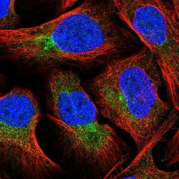 Anti-FUT8 antibody produced in rabbit affinity isolated antibody