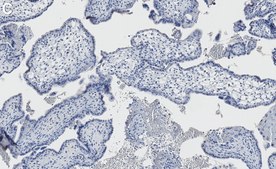 Anti-Transglutaminase 2 Antibody, clone 1G20 ZooMAb&#174; Rabbit recombinant, expressed in HEK 293 cells