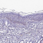 Anti-PRNP antibody produced in rabbit Prestige Antibodies&#174; Powered by Atlas Antibodies, affinity isolated antibody, buffered aqueous glycerol solution