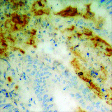 Anti-phospho-STAM2 (pTyr192) antibody produced in rabbit affinity isolated antibody