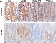 Anti-&#946;-Catenin antibody produced in rabbit whole antiserum
