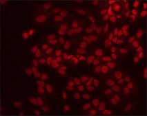 Anti-XRCC1 antibody produced in rabbit ~1&#160;mg/mL, affinity isolated antibody, buffered aqueous solution