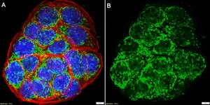 Anti-Trypsin Antibody, clone 1F6 ZooMAb&#174; Rabbit Monoclonal recombinant, expressed in HEK 293 cells