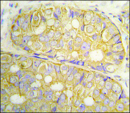 Anti-POTE (C-term L446) antibody produced in rabbit affinity isolated antibody, buffered aqueous solution