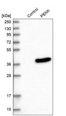 Anti-PENK antibody produced in rabbit Prestige Antibodies&#174; Powered by Atlas Antibodies, affinity isolated antibody, buffered aqueous glycerol solution
