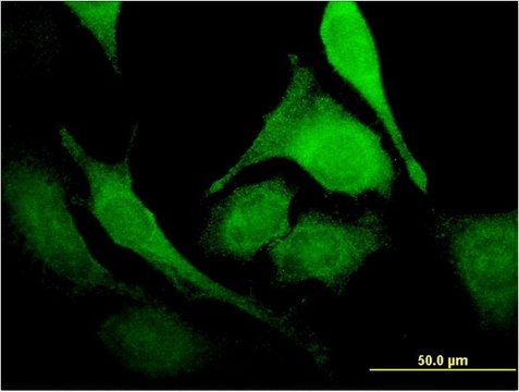 Monoclonal Anti-PUS1 antibody produced in mouse clone 3A3, purified immunoglobulin, buffered aqueous solution