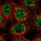 Anti-NDUFB6 antibody produced in rabbit Prestige Antibodies&#174; Powered by Atlas Antibodies, affinity isolated antibody, buffered aqueous glycerol solution