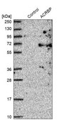 Anti-ACRBP antibody produced in rabbit Prestige Antibodies&#174; Powered by Atlas Antibodies, affinity isolated antibody, buffered aqueous glycerol solution