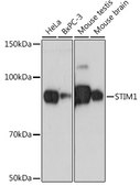 Anti-STIM1 Antibody, clone 1Z7E3, Rabbit Monoclonal