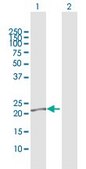 Anti-LCN2 antibody produced in rabbit purified immunoglobulin, buffered aqueous solution