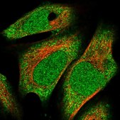 Anti-METTL16 antibody produced in rabbit Prestige Antibodies&#174; Powered by Atlas Antibodies, affinity isolated antibody, buffered aqueous glycerol solution