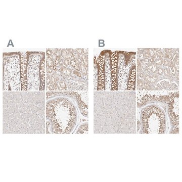 Anti-KCMF1 antibody produced in rabbit Prestige Antibodies&#174; Powered by Atlas Antibodies, affinity isolated antibody, buffered aqueous glycerol solution, ab2