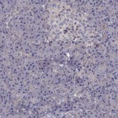 Anti-ITGB1 Prestige Antibodies&#174; Powered by Atlas Antibodies, affinity isolated antibody