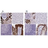 Anti-HSD11B2 antibody produced in rabbit Prestige Antibodies&#174; Powered by Atlas Antibodies, affinity isolated antibody, buffered aqueous glycerol solution