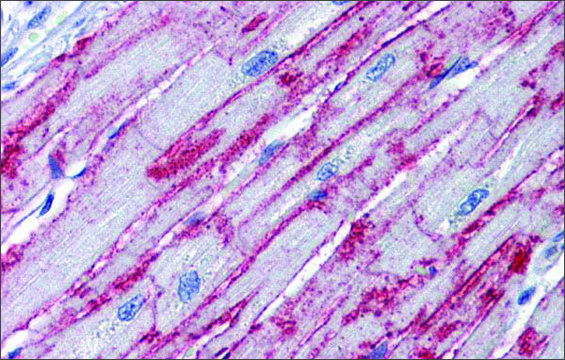 Anti-PNPT1 antibody produced in rabbit affinity isolated antibody