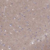 Anti-CACNG4 antibody produced in rabbit Prestige Antibodies&#174; Powered by Atlas Antibodies, affinity isolated antibody