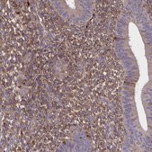 Anti-SFRP4 antibody produced in rabbit Prestige Antibodies&#174; Powered by Atlas Antibodies, affinity isolated antibody, buffered aqueous glycerol solution