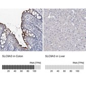 Anti-SLC9A3 antibody produced in rabbit Prestige Antibodies&#174; Powered by Atlas Antibodies, affinity isolated antibody, buffered aqueous glycerol solution