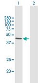 Anti-ALKBH1 antibody produced in mouse purified immunoglobulin, buffered aqueous solution