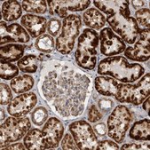 Anti-SFXN2 antibody produced in rabbit Prestige Antibodies&#174; Powered by Atlas Antibodies, affinity isolated antibody, buffered aqueous glycerol solution