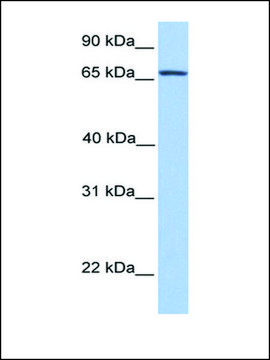 Anti-NR4A2 (AB2) antibody produced in rabbit affinity isolated antibody