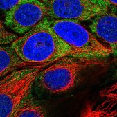 Anti-USH1C antibody produced in rabbit Prestige Antibodies&#174; Powered by Atlas Antibodies, affinity isolated antibody, buffered aqueous glycerol solution, ab1